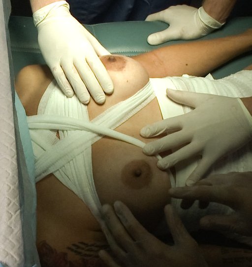 medical fetish and tits